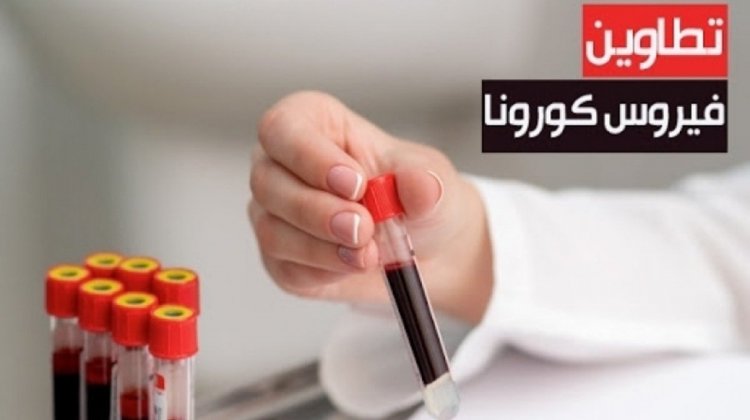  تطاوين.. اقتراب نفاذ الاوكسيجان وتحويل مرضى كورونا الى مستشفيات مجاورة 